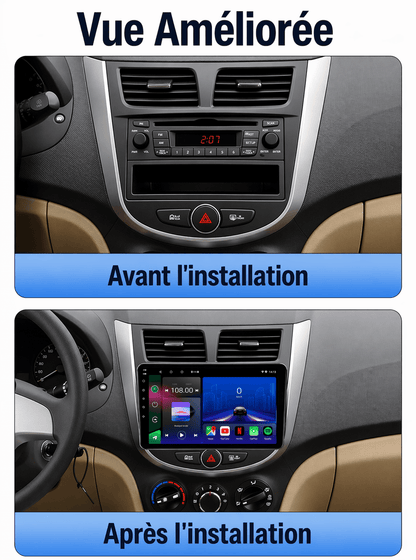 Hyundai Accent | 2011-2016 | Autoradio Android 15 | Carplay et Android Auto